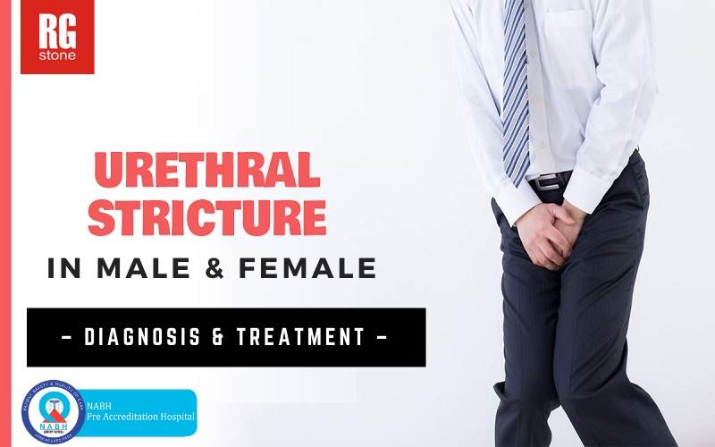 urethral-stricture.jpg