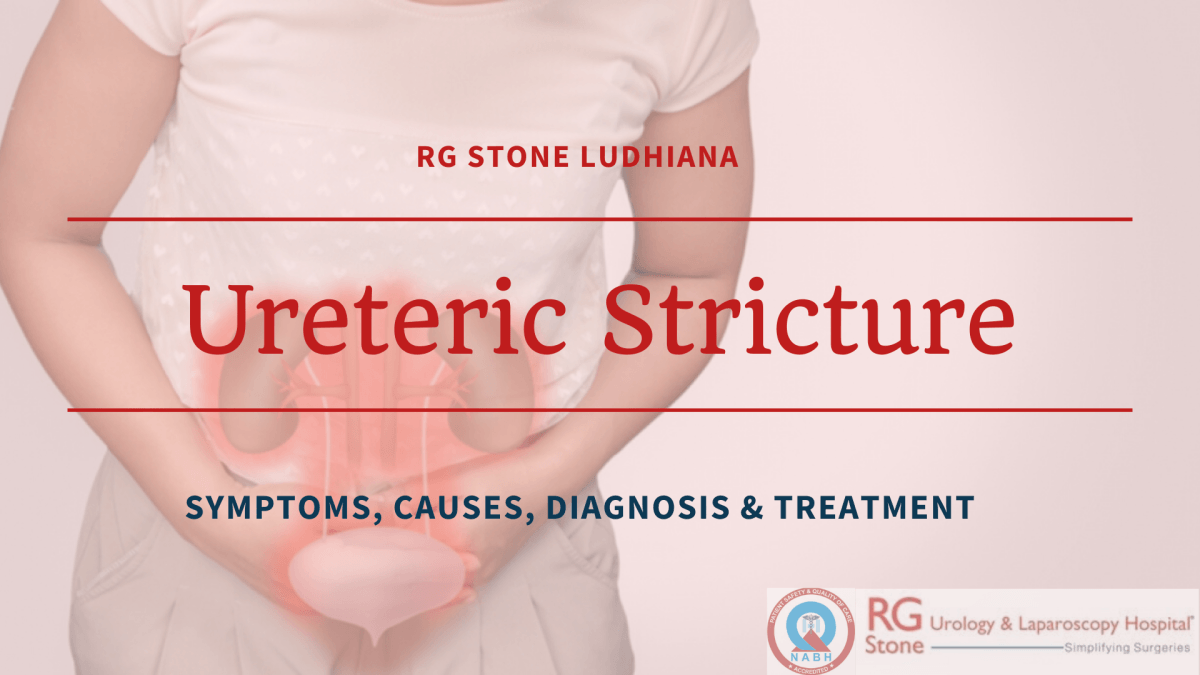 Ureteric stricture