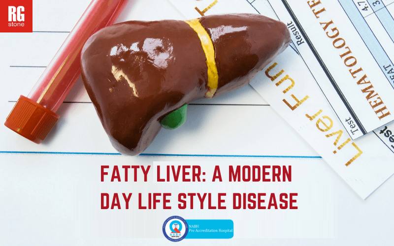 Fatty Liver: A modern day life style disease