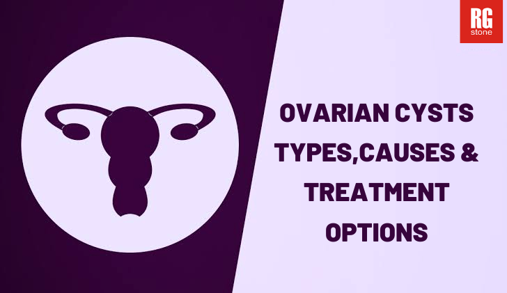 ovarian-cysts-types-causes-treatment-options.png