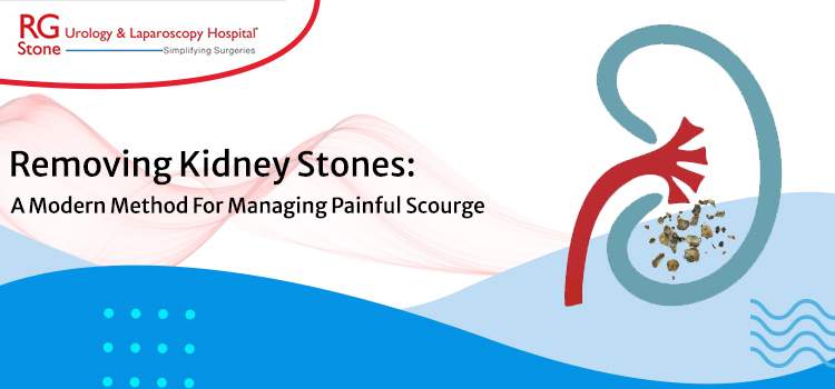 Removing Kidney Stones: A Modern Method For Managing Painful Scourge